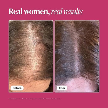 Viviscal Hair Growth Supplements